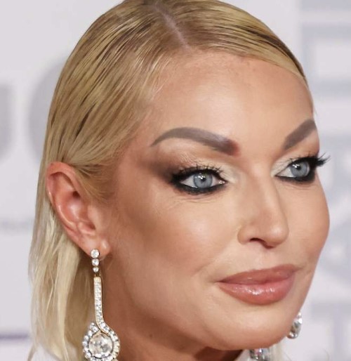 Анастасия Волочкова