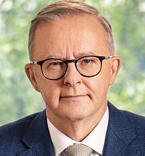 Энтони Албаниз